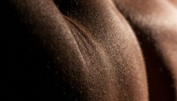 Depilacja laserowa pleców – skuteczny sposób na trwałe usunięcie owłosienia